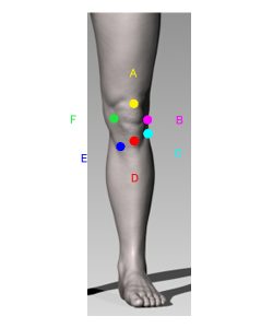 膝の痛み分類図