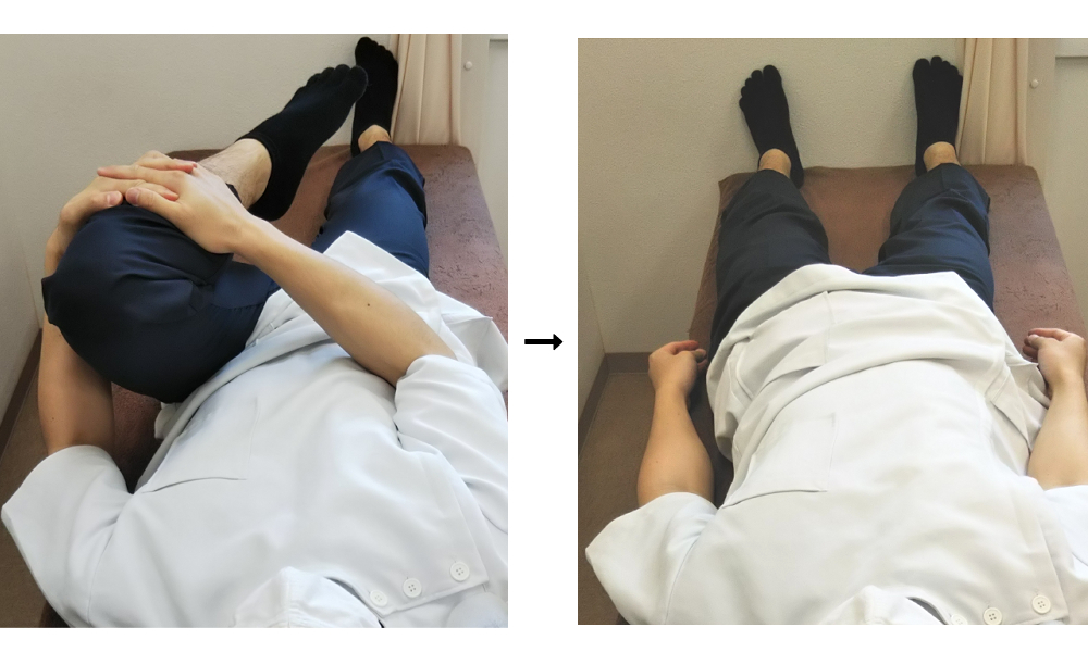 大腿筋膜張筋の治療図