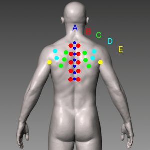 背中の痛み分類図