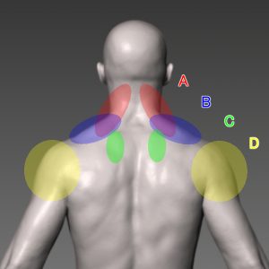 肩の痛み分類図