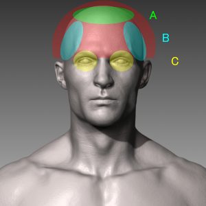 頭の痛み分類図