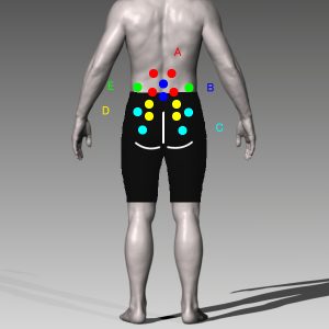 腰の痛み分類図