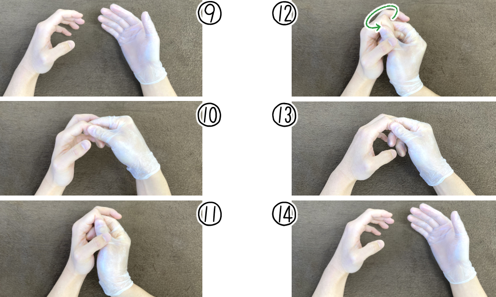 指関節(DIP・PIP)(6時方向)の靭帯・腱の治療法③