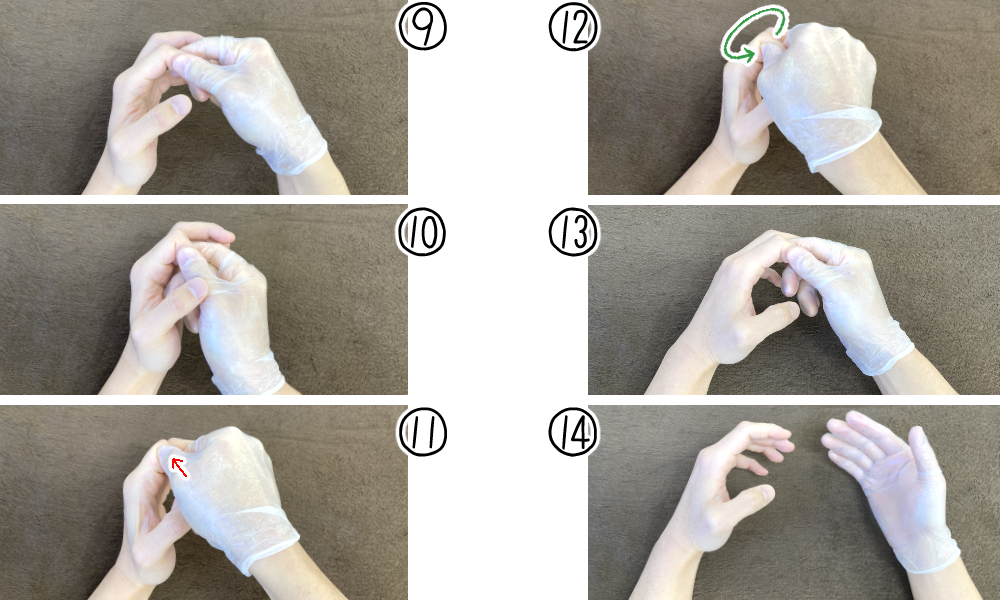 指関節(DIP・PIP)(7～8時方向)の靭帯・腱の治療法③