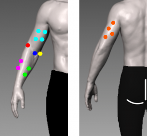 肘の痛み分類図