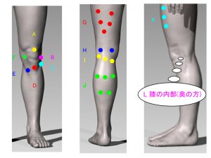 膝の痛み分類図